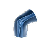 Elbow X-Ray